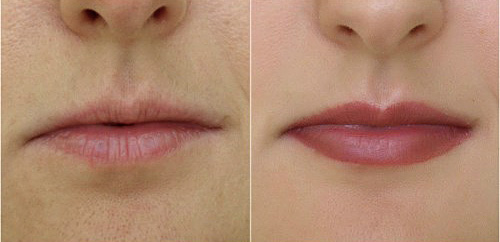 Перманентный макияж губы до и после